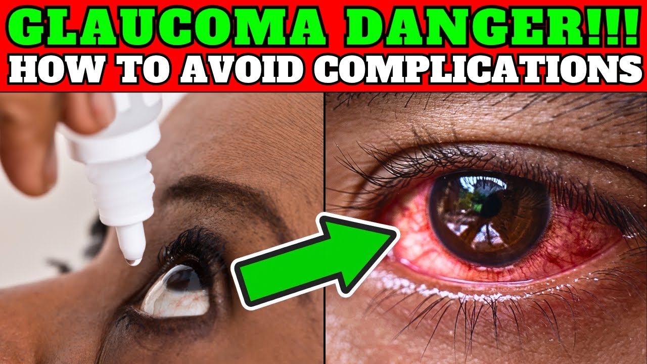 5 Critical Tips to PREVENT GLAUCOMA Complications in SENIORS! - YouTube