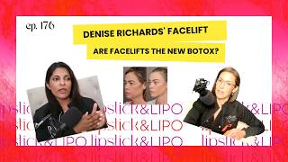 Denise Richards' facelift - Are facelifts the new Botox?