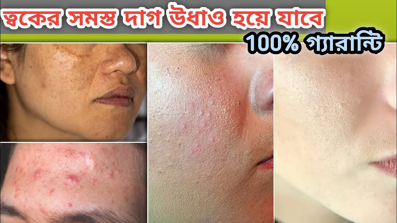 Summer Skin Care Routine for Glowing Skin - YouTube