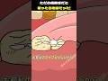 ただの歯抜きだと思ったら地獄だった