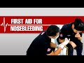 Nose Bleeding First Aid Application and other Tips you Might Need