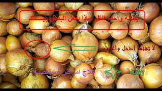 بصلة واحدة معجزة قل وداعا للآلام والأمراض بعد اليوم | فوائد البصل الوقائية والعلاجية من الأمراض