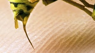 10 Most Painful Insect Stings In The World by Amazing Top 10s 38,733 views 7 years ago 3 minutes, 39 seconds