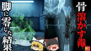 【1994】『硫酸より怖い液体』を足に零してしまった研究者の体内で一体何が起きていたのか?歴史の中で最も教訓的かつ恐ろしい『フッ化水素酸飛散事故』を解説