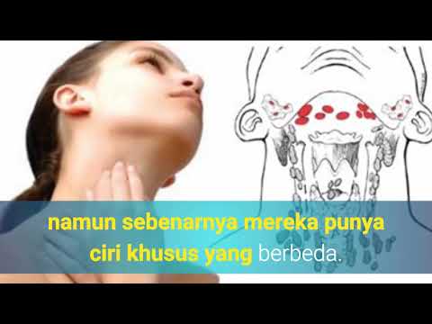 CARA MENGATASI SAKIT PIPI|SAKIT TELINGA BAHAGIAN DALAM|SAKIT TULANG RAHANG|SAKIT KEPALA SEBELAH. 