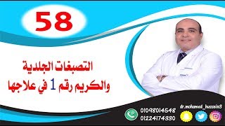 التصبغات الجلدية والكريم رقم 1 في علاجها .. للدكتور محمد حسين - 58