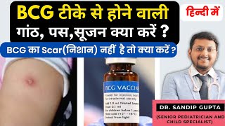 BCG टीके से गांठ, पस, सूजन क्या करें ? | BCG का Scar(निशान) नहीं है तो क्या करें ? | BCG REACTION