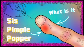 POPPING A VERY SUSPICIOUS VERY PAINFUL BUMP ON FINGER | SPIDER BITE? PARONYCHIA? CYST?
