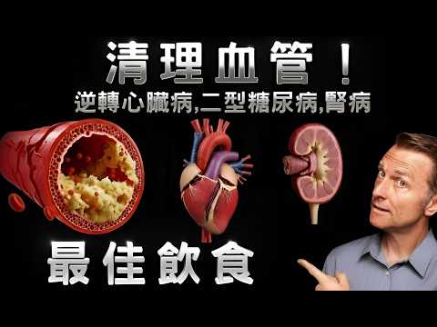 清血管這樣吃就對了！逆轉三高、改善心臟病、糖尿病、慢性腎臟病的科學飲食法