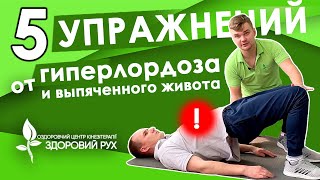 5 упражнений при гиперлордозе, как убрать выпячивание живота | КИНЕЗИТЕРАПИЯ