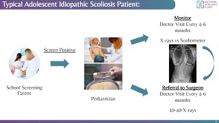 How Can You Tell If Your Child Has Scoliosis? National Scoliosis Clinic Webinar 62223