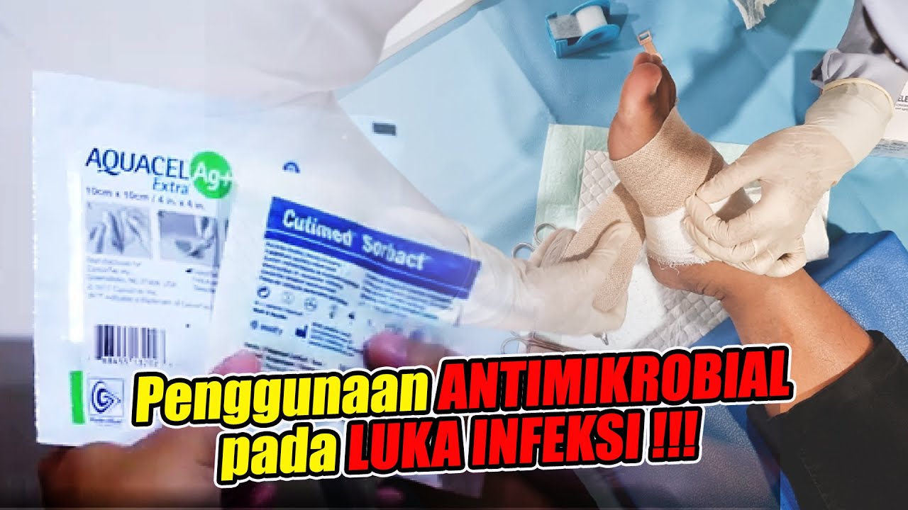 Rekomendasi Dressing / balutan luka untuk mengatasi infeksi pada luka