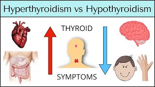 Hyperthyroidism vs Hypothyroidism: Symptoms MADE EASY [Thyroid Explained] by EZmed 55,468 views 2 years ago 16 minutes