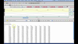 AcqKnowledge Pulmonary Airflow