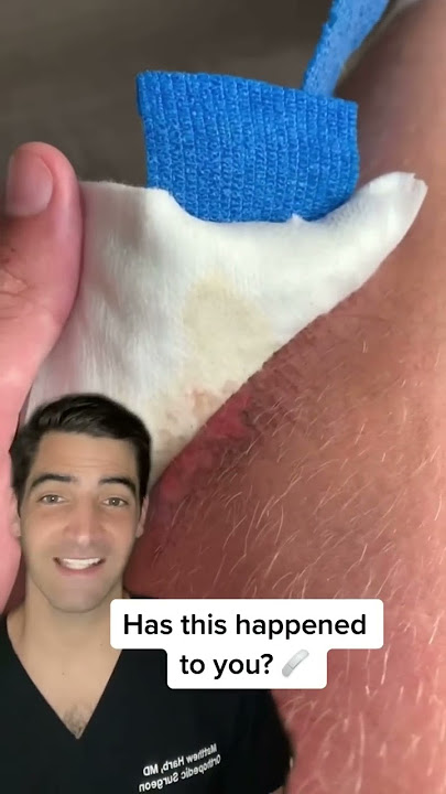 Non Adhesive Bandage