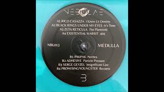 Zeta Reticula – [[The Planetoid]