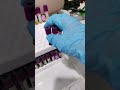 Complete Blood Count Procedure Laboratory Mls Cls Medtechstudent Blood Hematology 