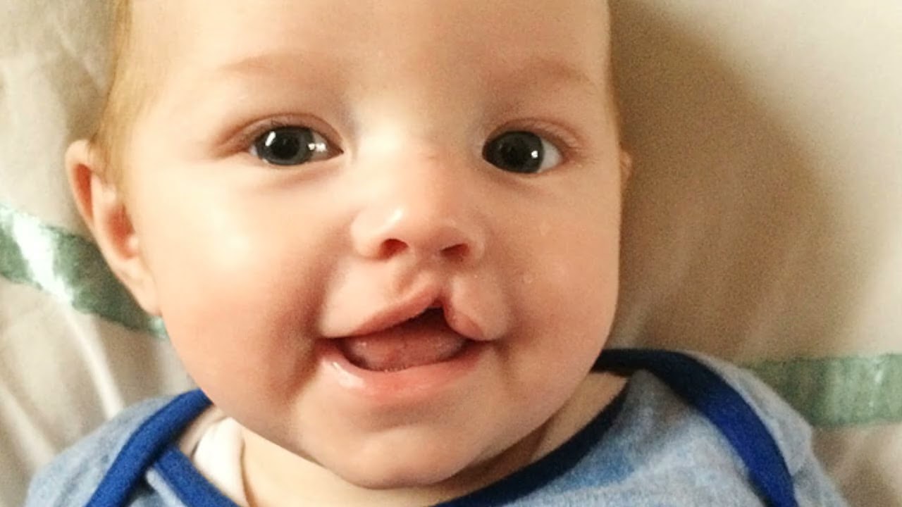 Dr. Archna Soni, M.B.B.S., D. C.H || Soni Burn & Plastic Surgery Hospital