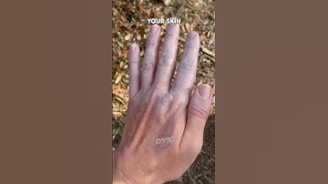 What Happens When You Touch Dry Ice 🧊