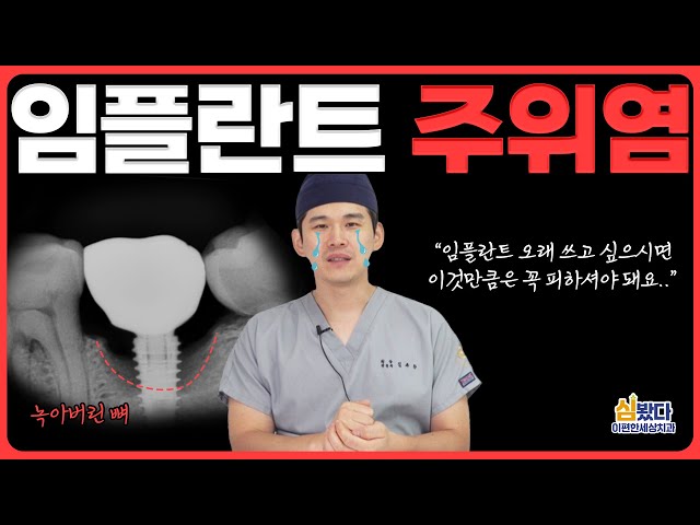 임플란트 비싼 돈 들여서 심어놨는데 빼야 한다고?😱 주적 '임플란트 주위염'에 대한 모든 것☠️ ｜ #임플란트주위염 #임플란트치과 #치과정보