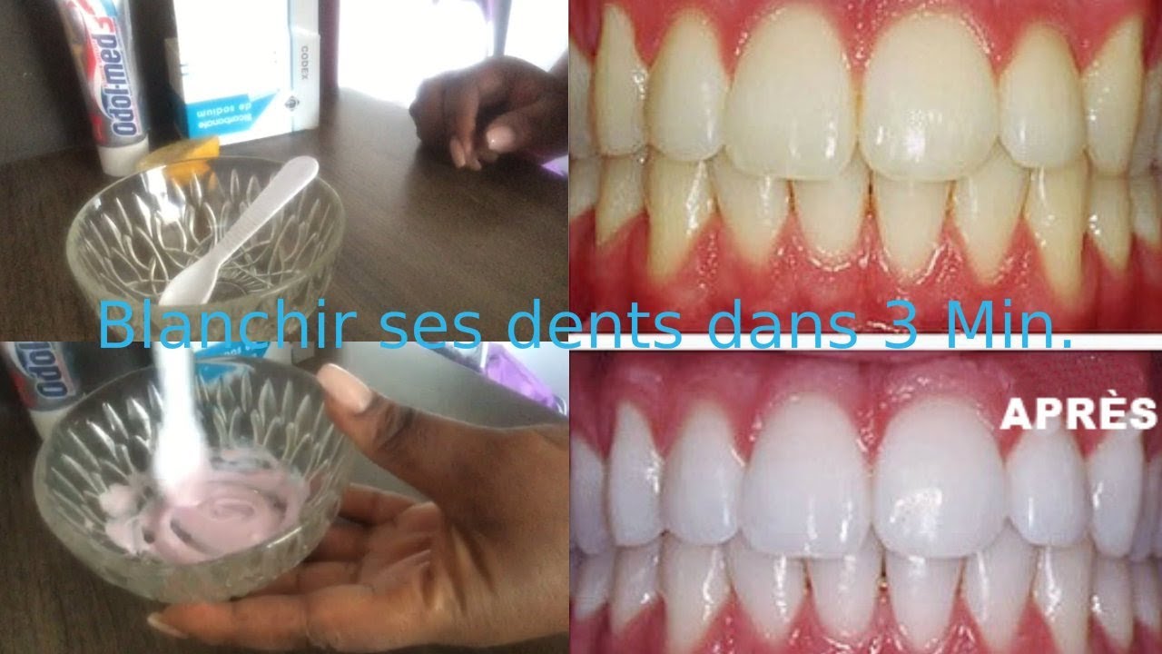 Comment blanchir ses dents dans 3 Min.??? - YouTube