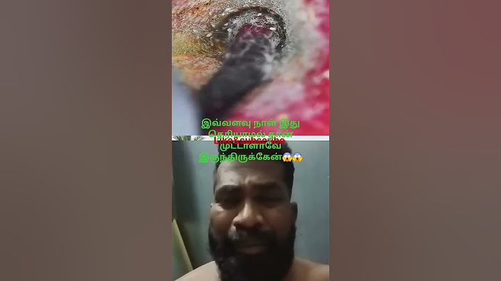 கவனம் தேவை#funny#memes#microscope#apple#viralvideo#viralshort#video#trending#reels#doctor#reelsvideo