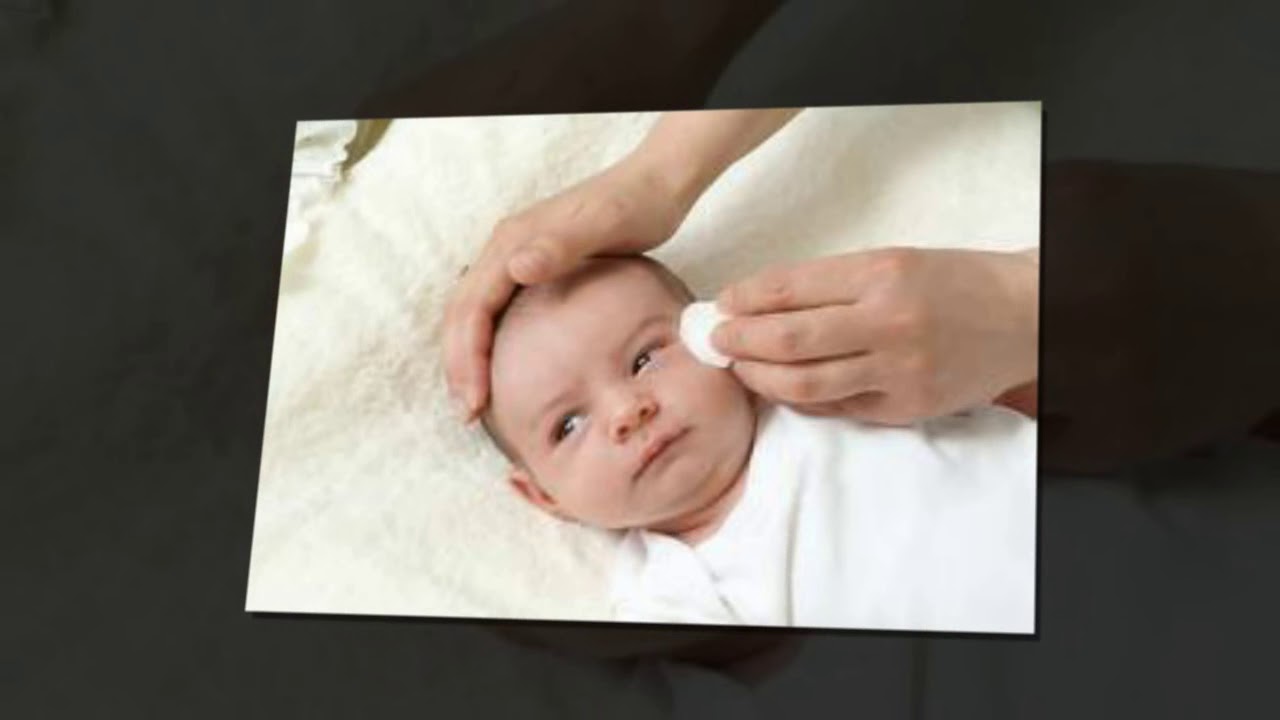 How to clean your baby's eyes YouTube