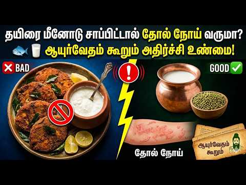 தயிர் உயிருக்கு ஆபத்து! அய்யோ Curd Side Effects in Tamil Curd Health Tips in TamilTamil News