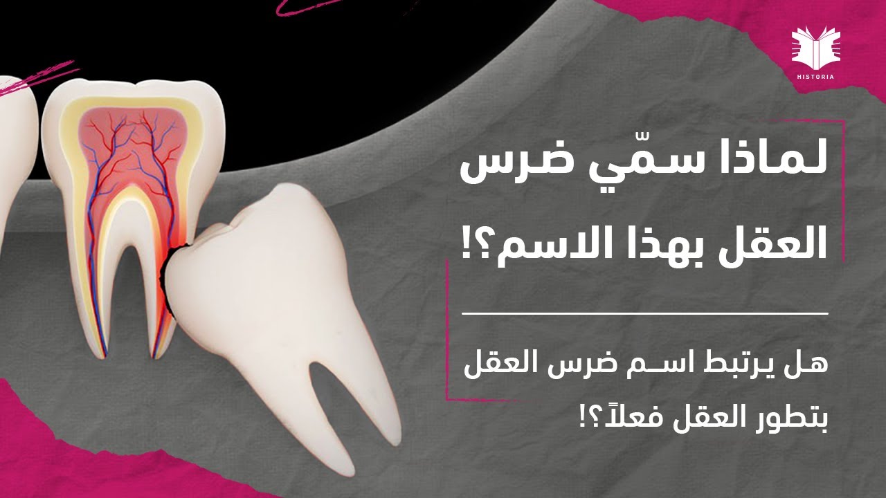 لماذا؟! | لماذا سمّي ضرس العقل بهذا الاسم؟! - YouTube