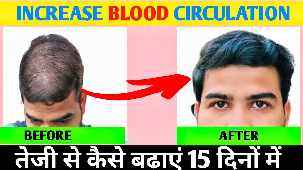 How To Increase Blood Circulation On Scalp For Hair Growth how-to-increase-blood-circulation-on-scalp-for-hair-growth
