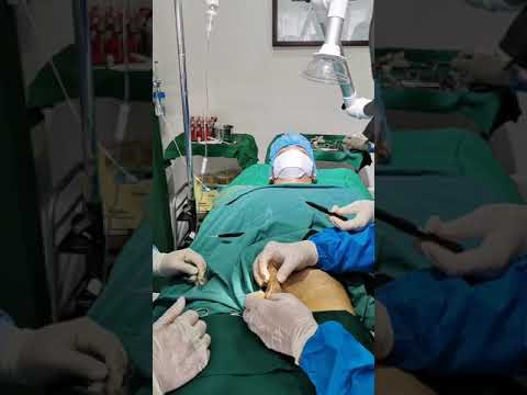 Flaccid Penis Erectile Dysfunction How To Treat It By Dr Beer