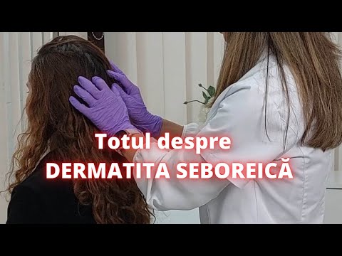 Video: 6 moduri de a trata dermatita