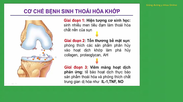 Cgiáo dục sức khỏe bệnh nhân thoái hóa khớp