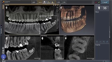 SICAT ENDO, General Functions