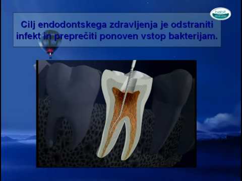 Video: Črne Dlesni In Pege Na Dlesni: Vzroki, Zdravljenje In še Več