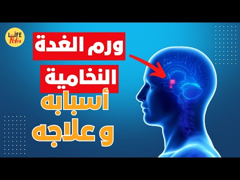 ورم الغدة النخامية اسباب ورم الغدة النخامية اعراض ورم الغدة النخامية علاج ورم الغدة النخامية