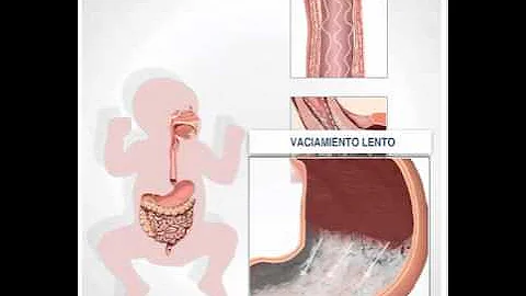 ¿Cuánto tarda el aparato digestivo del bebé en acostumbrarse a la leche de fórmula?