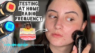 RADIO FREQUENCY for Collagen Production, Skin Tightening & Acne Scars