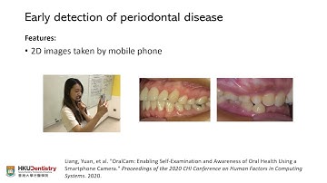 Artificial intelligence (AI) in dentistry/oral health Part 2: Applications