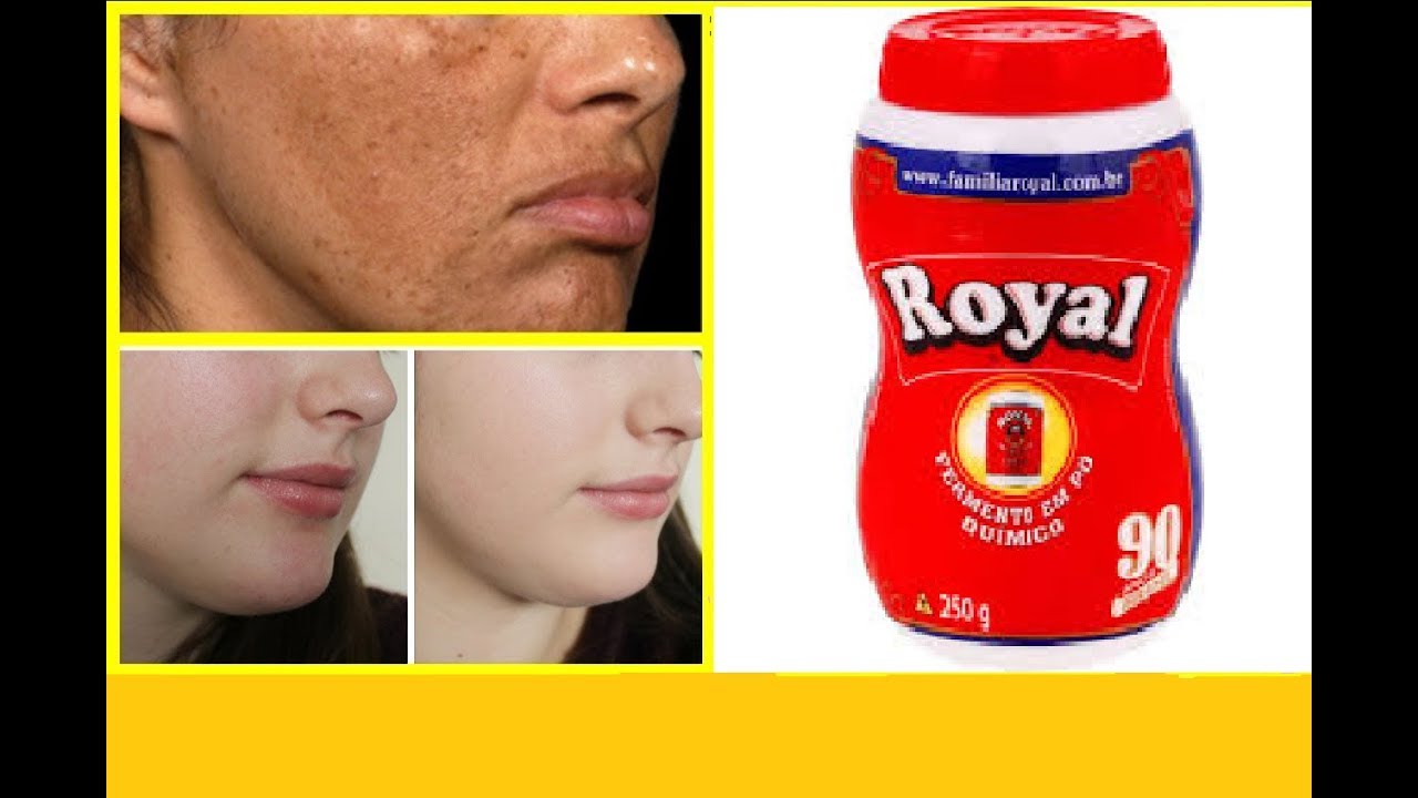 PELE de Bebê em 2 DIAS! USE PÓ ROYAL para Remover MANCHAS e RUGAS da ...