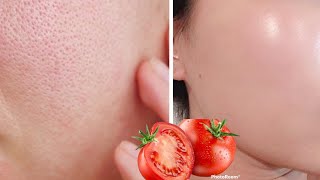 Apply tomatoes on large pores , wrinkles and dark spots, then watch the magic