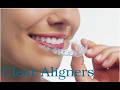 Clear Aligners: The Modern Way to Straighten Teeth