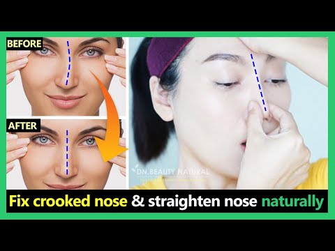 How To Fix A Deviated Septum Without Surgery - Fix crooked nose, uneven nose tip, deviated nose & straighten nose naturally | Exercises & Massage.