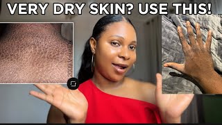This Is The BEST LOTION For Dry, Flaky, Scaly, Rough and Hard Skin