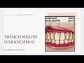 Trench mouth diseaseanug