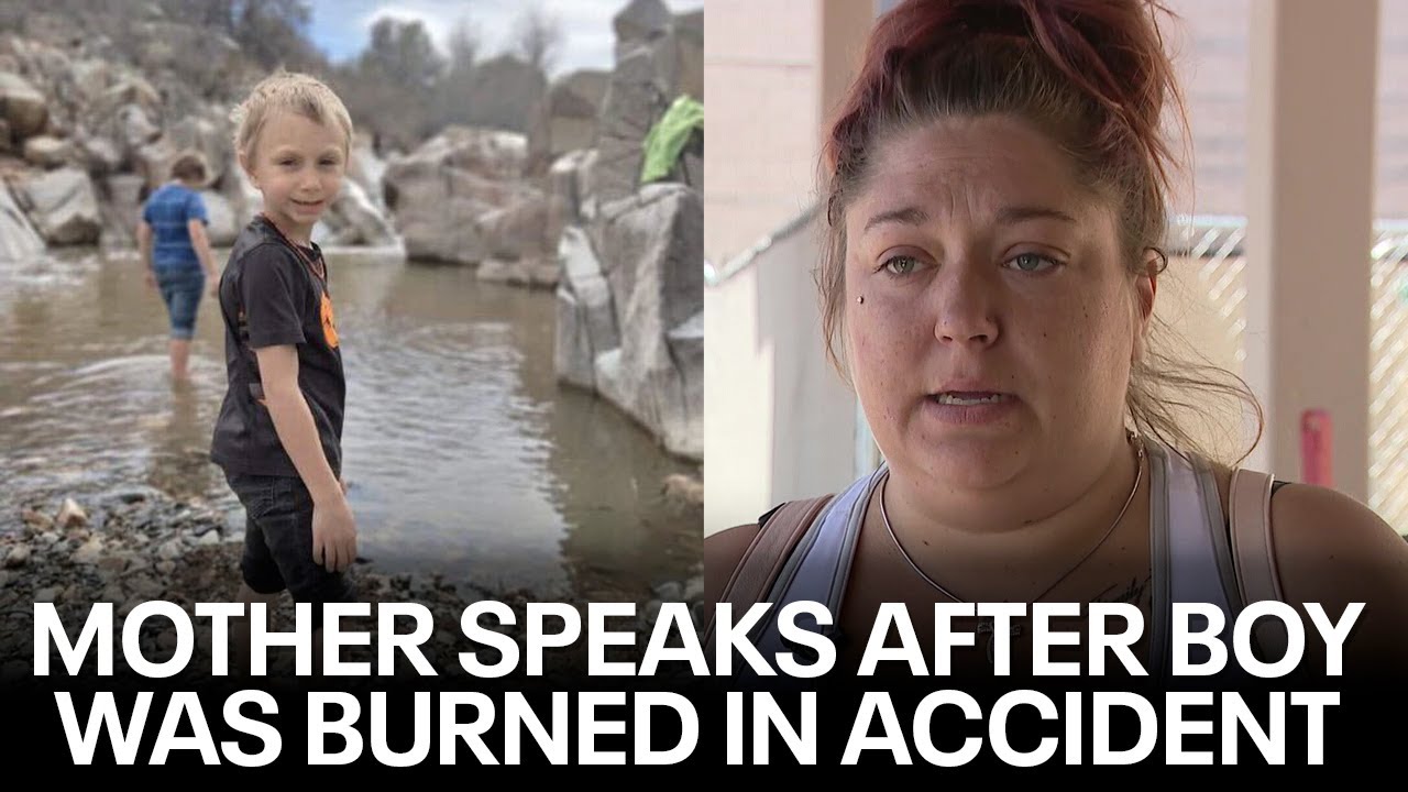 Mother speaks out after Prescott boy was badly burned - YouTube