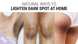 How To Lighten Dark Underarms, Knees & Elbows | Skin Brightening Tips for Dark Spot