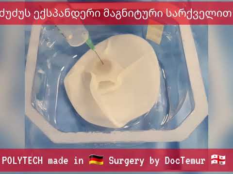 ძუძუს ექსპანდერი მაგნიტური სარქვლით