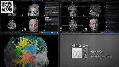 nordicBrainEx with DCE module