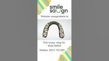 Phác đồ niềng răng - Smilesalign Việt Nam
